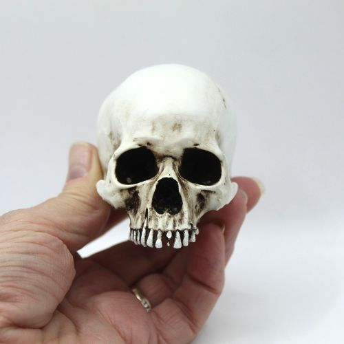 Anatomically Correct HUMAN JAWLESS SKULL